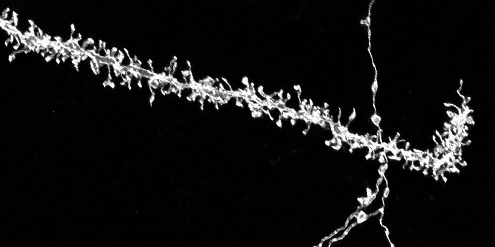 Axon and dendrite crossover image